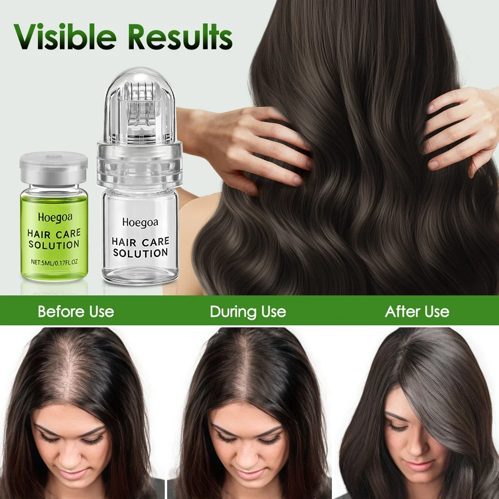 Hair Essential Care Serum Strengthen Roots Reducing Loss Prevent Baldness Nourish Scalp Hair Care Anti-Hair Loss Conditioner 4