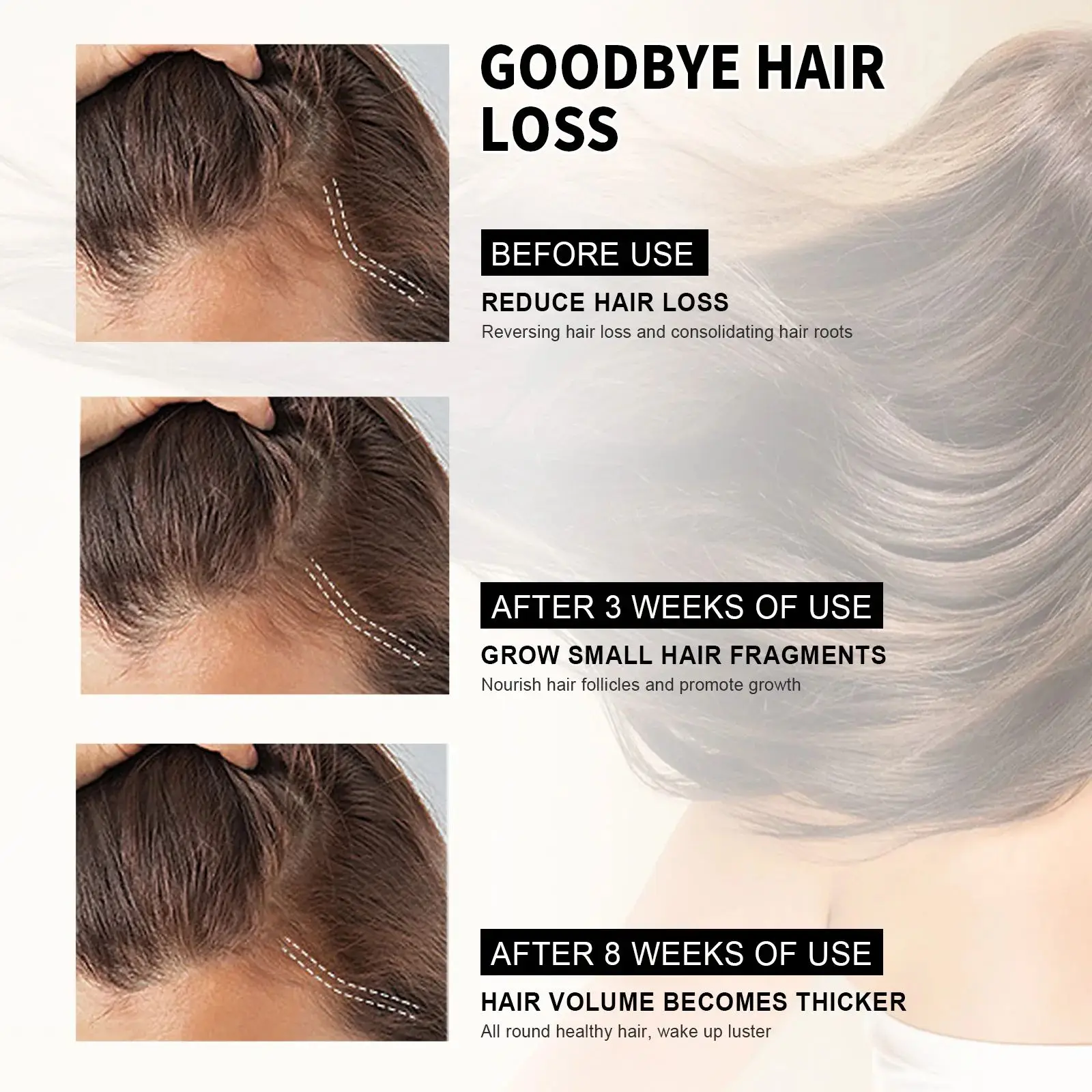 Hair Growth Shampoo Anti Hair Loss Anti-dandruff Repair Damaged Scalp Follicles Fast Baldness Treatment Hair Regrowth Care 60ml 5
