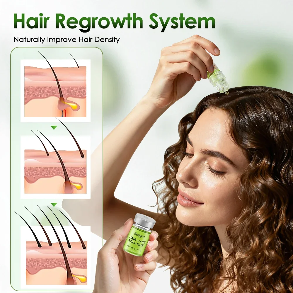 Hair Essential Care Serum Strengthen Roots Reducing Loss Prevent Baldness Nourish Scalp Hair Care Anti-Hair Loss Conditioner 3