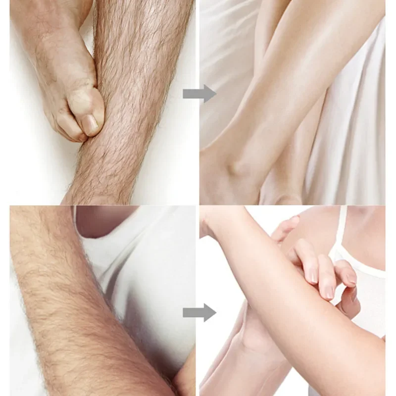 20stick Professional Hair Removal Wax Strips for Summer Depilation Double Sided Cold Wax Paper for Leg Body Face Useful 4