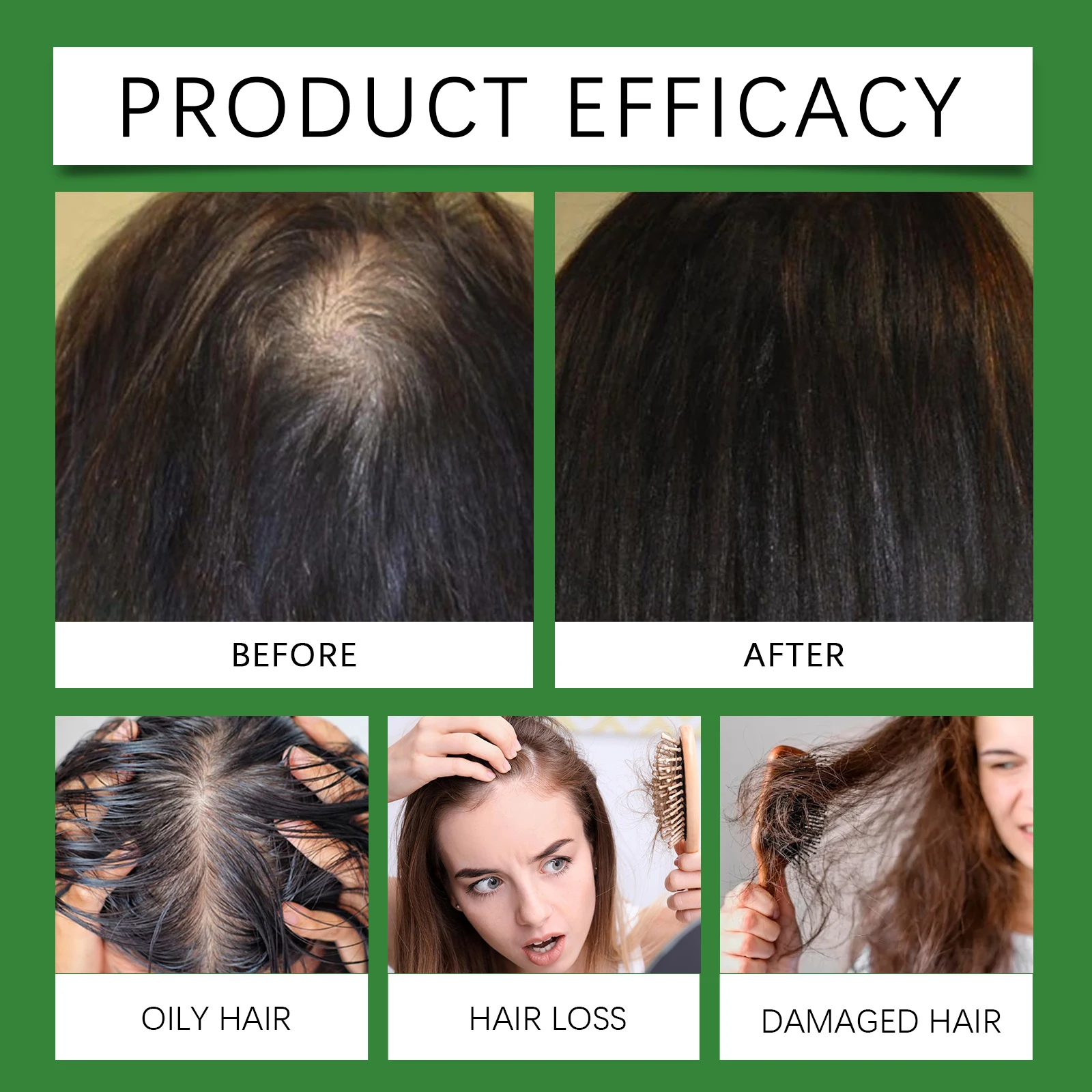 Rosemary Hair Spray With Rice Water Dry Damaged Hair Care Oil For Scalp Hydrating Nourish Anti-Flake Soft Smooth Strengthen Mist 5