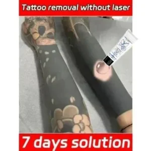 30g Tattoo Removal Gel Dissolve Tattoo Repair Skin Moisturizing Painless Deep Cleansing Care gel Feamle Makeup Product 1