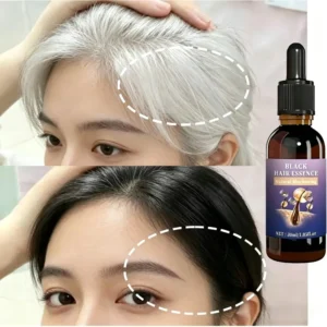 Hair Strengthening Black Essence - Balances Scalp Oil & Unclogs Follicles, Improves Hair Shine. 1