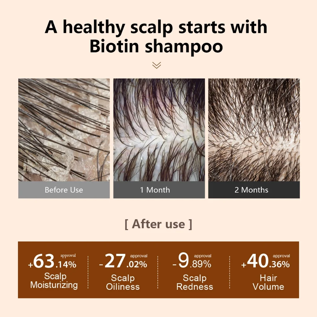 PURC Biotin Hair Shampoo Conditioner for Men Women Scalp Cleaning Hair Root Nourish Oil Smoothing Hair Mask Care Products Set 5