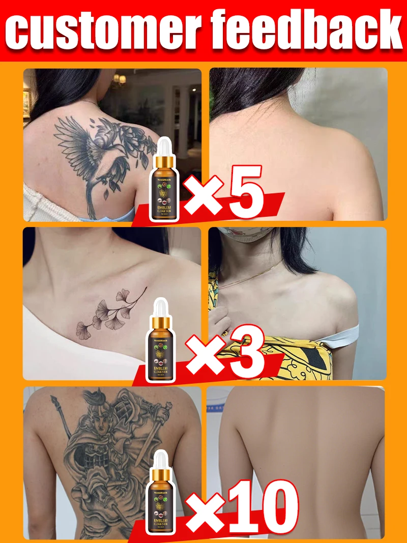 Pigmented permanent makeup tattoo removal Tattoo quick removal 3