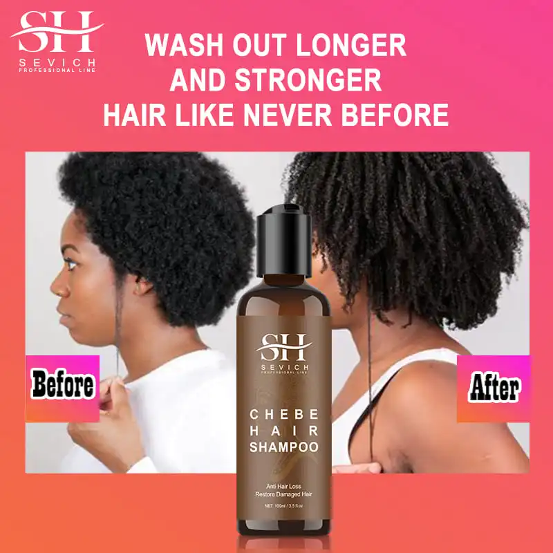 CHEBE Hair Growth Shampoo Conditioner Set Anti Hair Loss Treatment for Men Women Fast Thicken Regrowth Oil Beauty Health SEVICH 6