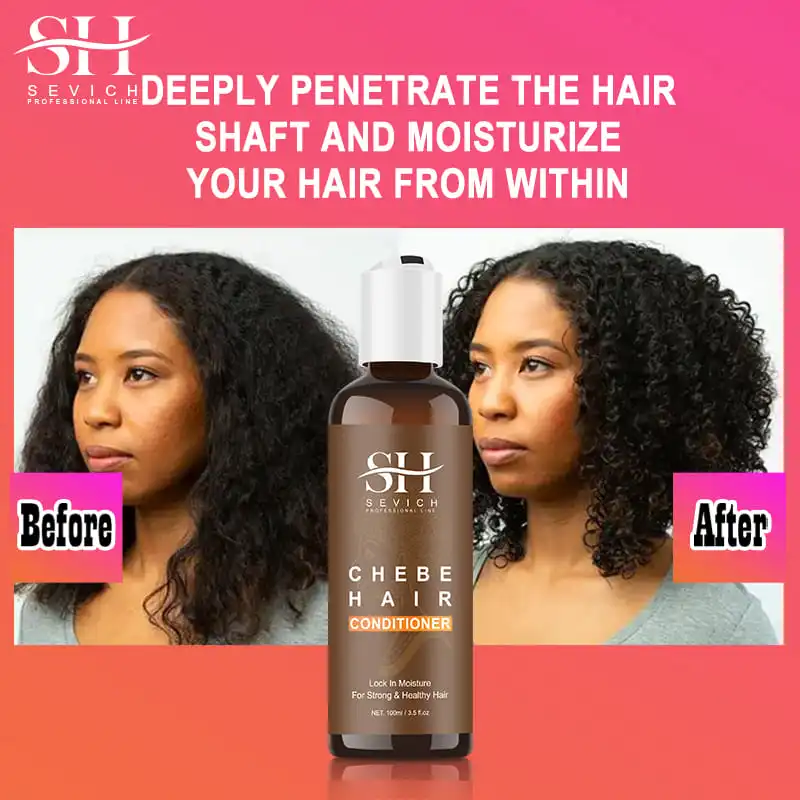 CHEBE Hair Growth Shampoo Conditioner Set Anti Hair Loss Treatment for Men Women Fast Thicken Regrowth Oil Beauty Health SEVICH 5