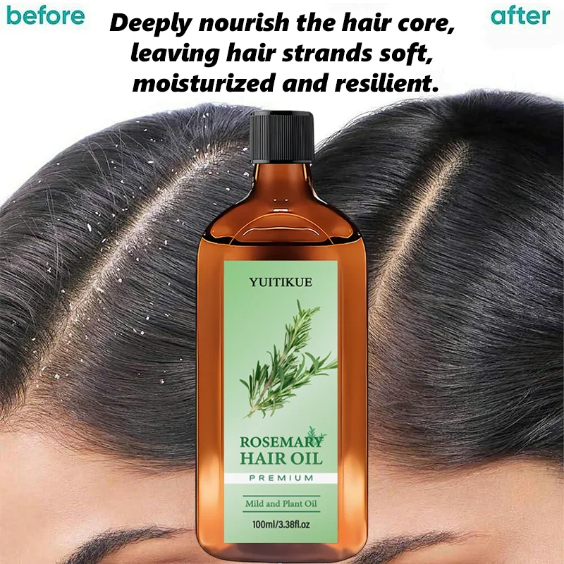 YUITIKUE Premium Rosemary Hair Oil | Mild Plant-Based Formula | For Gentle Hair & Scalp Nourishment & Healthy Hair Care 100ml 6
