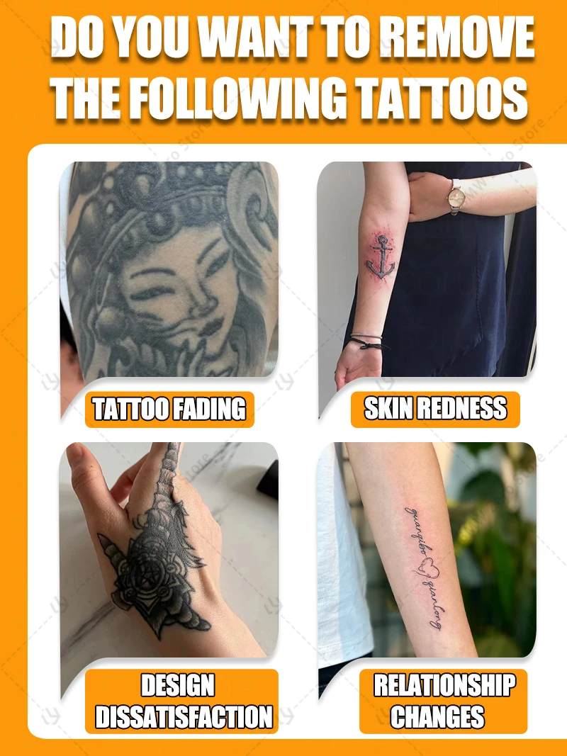 Pigmented permanent makeup tattoo removal Tattoo quick removal 2