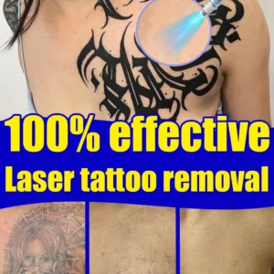 ᴀʟʟ ᴛᴀᴛᴛᴏᴏs Nano laser removes all tattoosᴺᵃⁿᵒ ˡᵃˢᵉʳ ʳᵉᵐᵒᵛᵉˢ ᵃˡˡ ᵗᵃᵗᵗᵒᵒˢ 1
