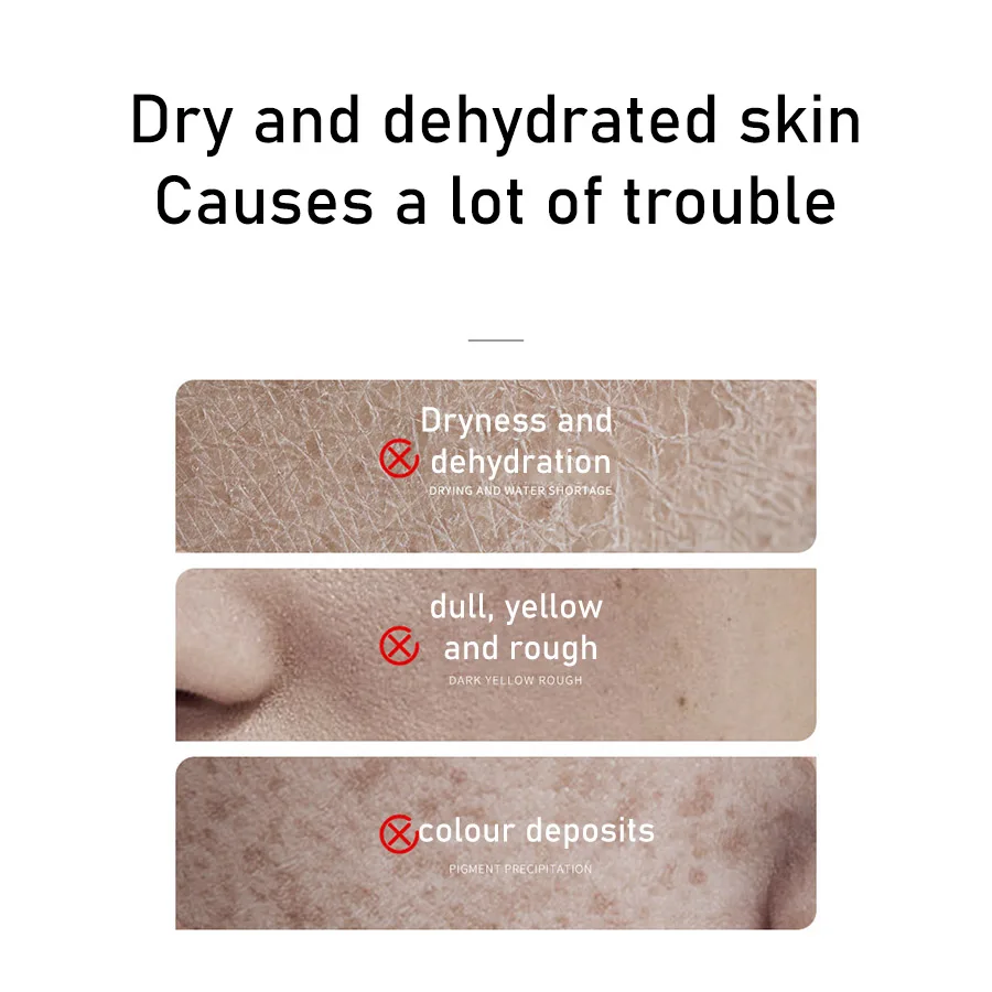 Rice Toner 70% Rice Extract Serum with Niacinamide, Rice Cleansing Foam, Deep Cleansing, Moisturizer for Dry Skin, Skin Care Set 6